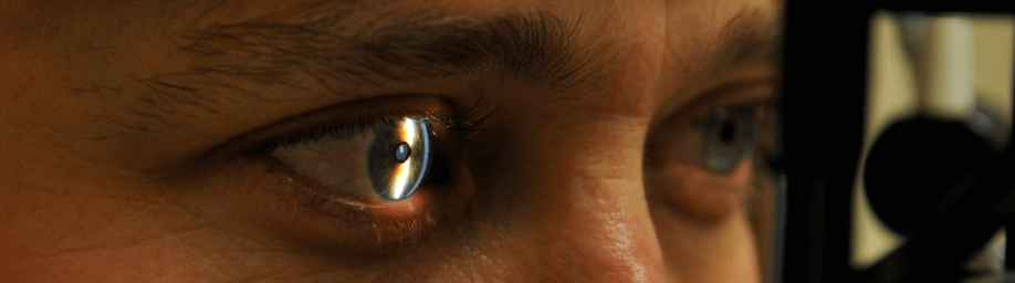 Obstruções Vasculares da Retina